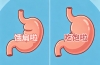 胃真的越撑越大,越饿越小吗?